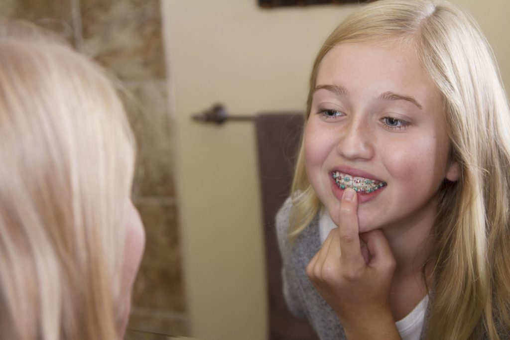 Girl with blonde hair smiling and pointing at her colorful metal braces in a bathroom mirror, representing orthodontic care at Smiles to Love Orthodontics in Dublin.